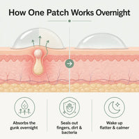 Hydrocolloid Acne Patches