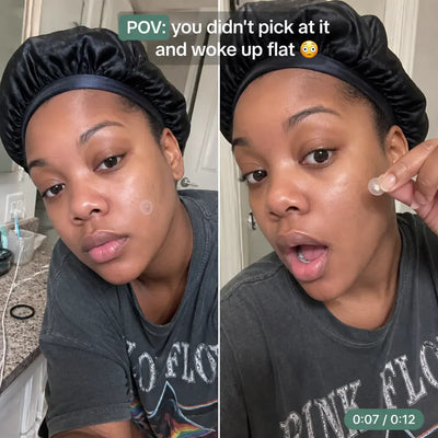 Hydrocolloid Acne Patches