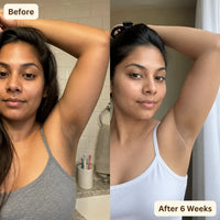 MyAvazon - Turmeric Cleansing Soap Bar