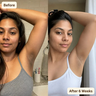 MyAvazon - Turmeric Cleansing Soap Bar